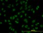 AKT2 Antibody (monoclonal) (M01)